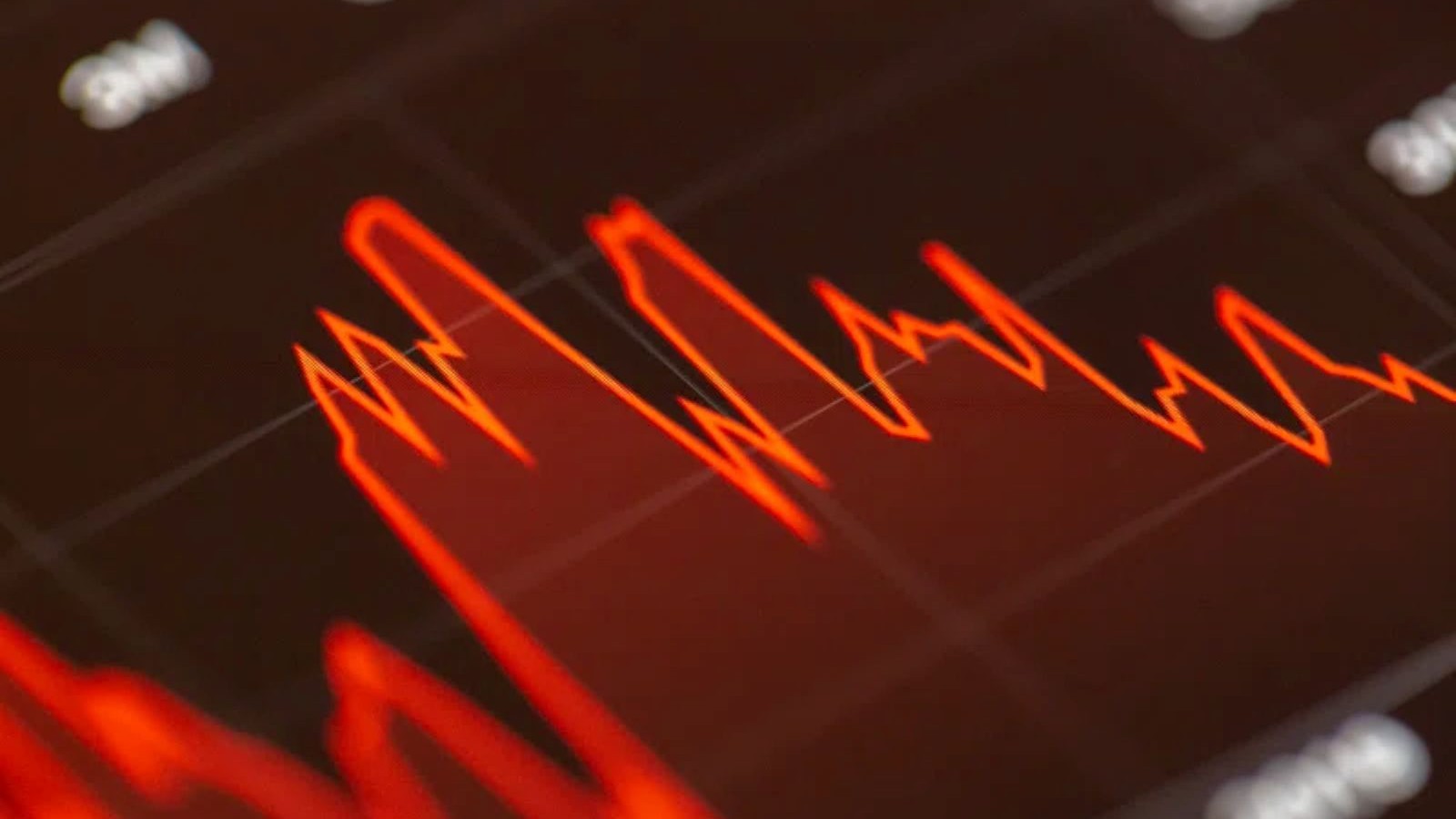 BetMGM Delays $500M EBITDA Goal, Cites Prediction Markets